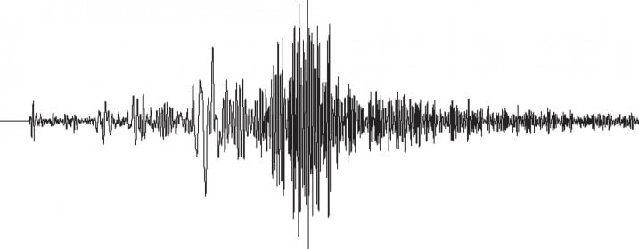 Changes in the ACI 318 Anchoring to Concrete Seismic Provisions